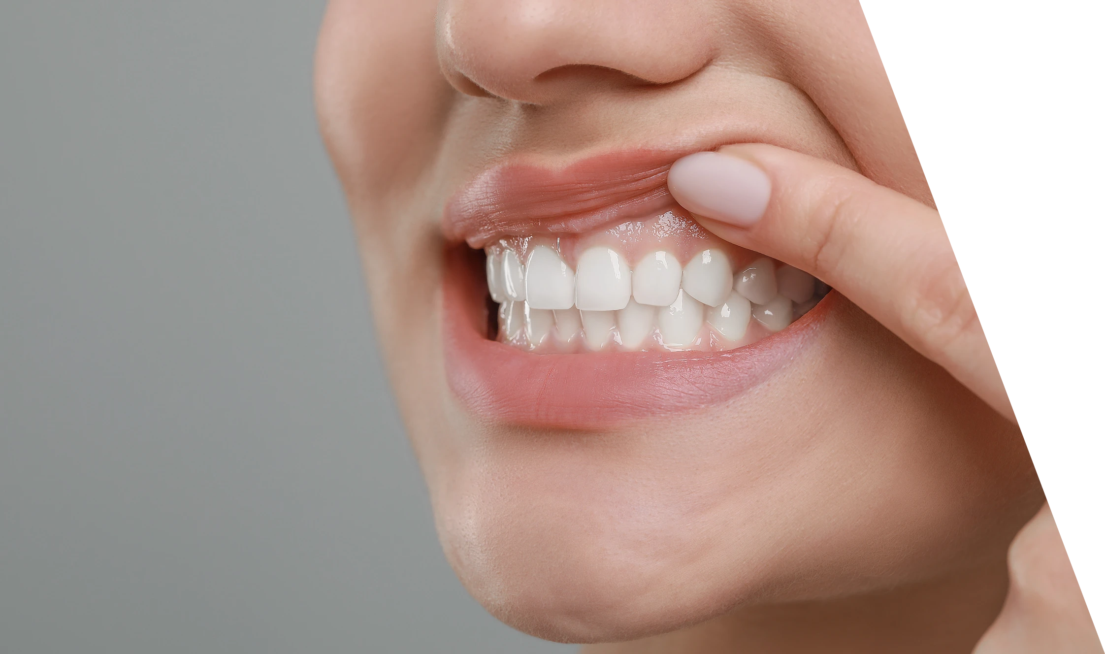 soins gencives dr dard Brouillon auto